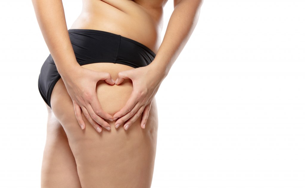 woman-with-cellulite-in-black-underwear.jpg woman-with-cellulite-in-black-underwear.jpg
